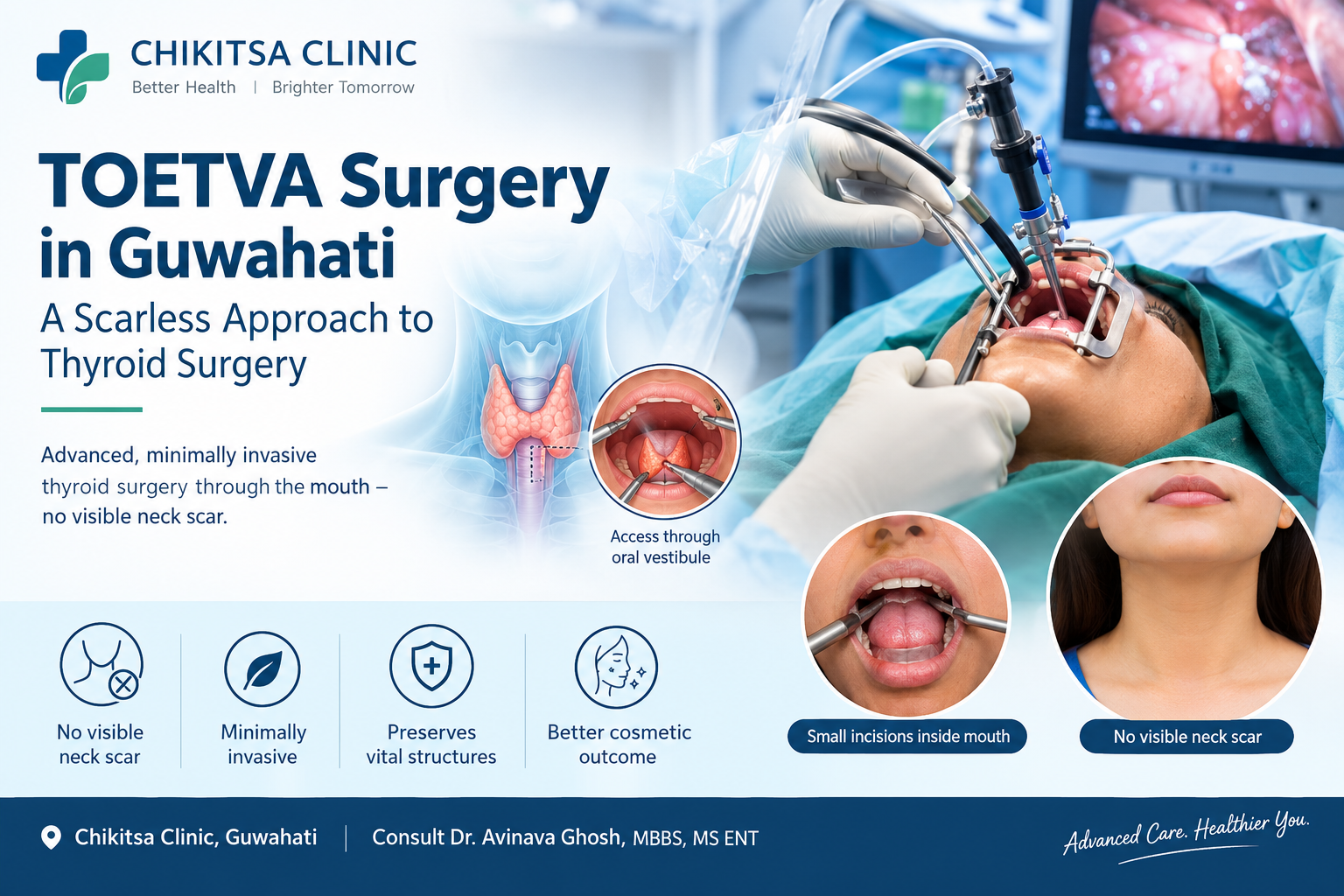TOETVA Surgery in Guwahati | Scarless Thyroid Surgery | Chikitsa Clinic