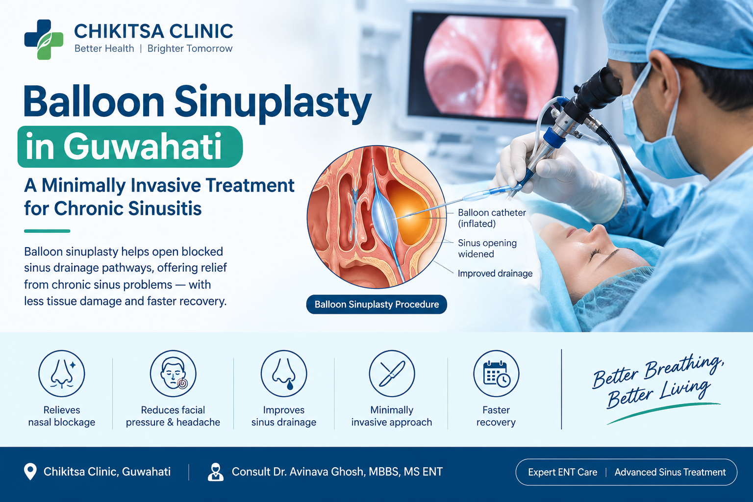 Balloon Sinuplasty in Guwahati: A Minimally Invasive Treatment for Chronic Sinusitis